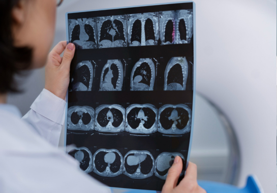 X-ray
